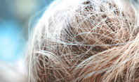 Détail de cheveux fins et mouillés répartis de manière désordonnée sur la tête.